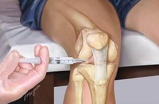Injectie door Hyaluron