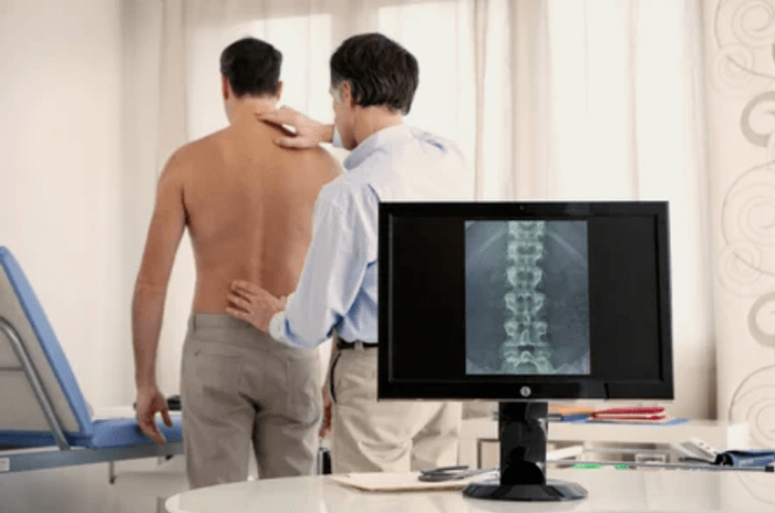 Osteochondrose van de lumbosacrale afdeling
